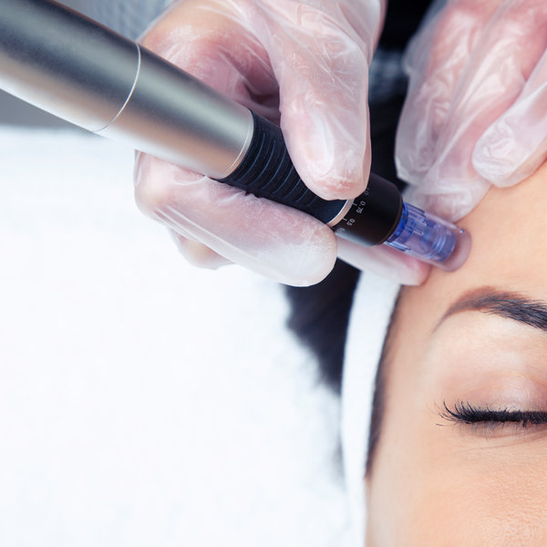 Precision skin treatment in progress